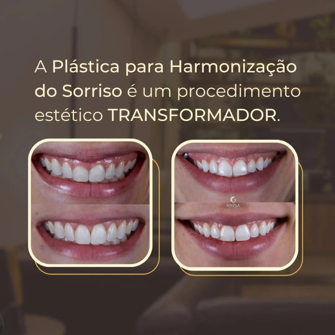 Plastica-Sorriso-2