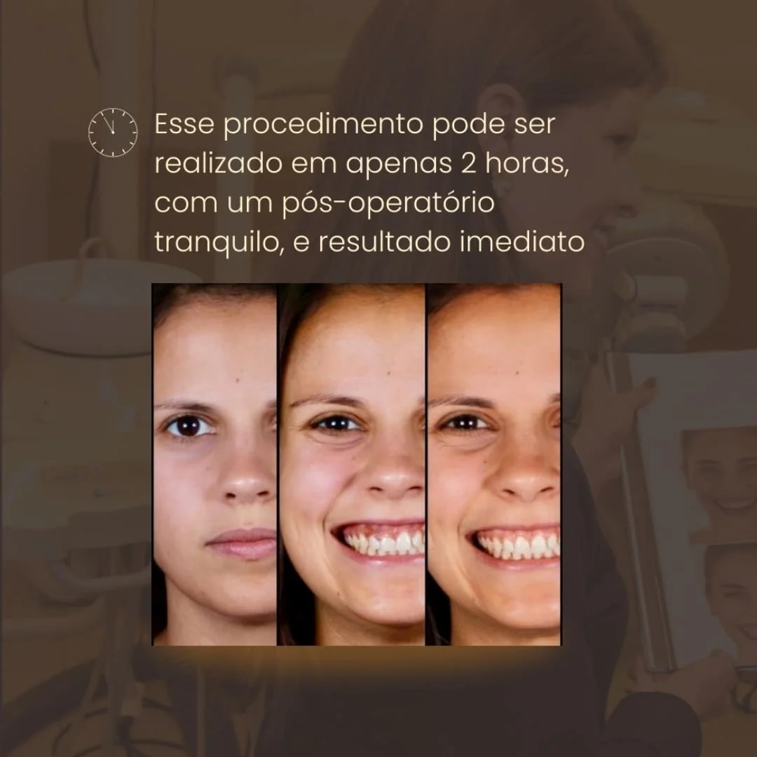 Plastica-Sorriso-6